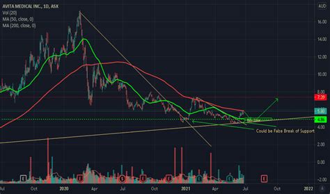AVH Stock Price and Chart — ASX:AVH — TradingView.